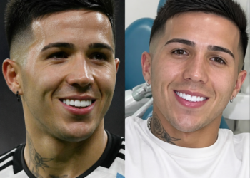 La odontóloga de Enzo Fernández comparte su experiencia sobre los cambios en la sonrisa del campeón del mundo