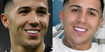 La odontóloga de Enzo Fernández comparte su experiencia sobre los cambios en la sonrisa del campeón del mundo